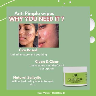 House of Beauty ANTI PIMPLE WIPES with 2% SALICYLIC ACID & CICA (55 PADS) 55's - Facial Wipes & Tissues