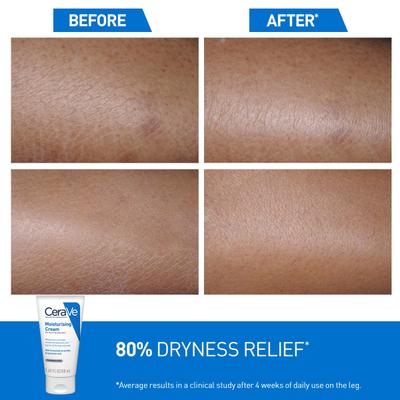 CeraVe Moisturising Cream For Dry To Very Dry Skin 177 ml - Lotions & Creams