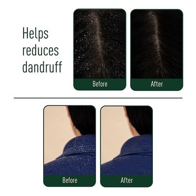 Neem Ayu Effective Ayurveda Anti Dandruff Oil 100 ml - Hair Oils