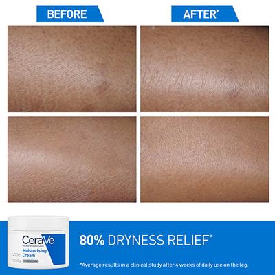 CeraVe Moisturising Cream For Dry To Very Dry Skin 340 gm - Lotions & Creams