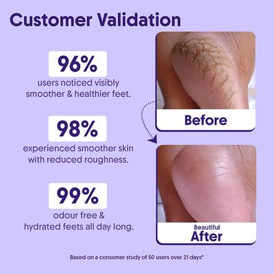 Aravi Organic AHA BHA Foot Roll-on 5% Lactic Acid 2% Glycolic Acid Urea Free for Cracked Heels 50 ml - Foot Care