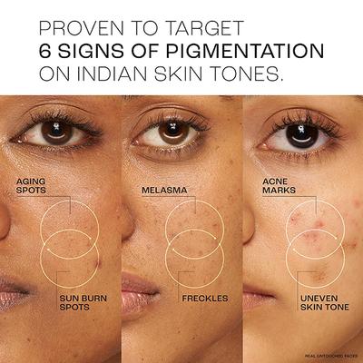 Lakme Absolute Perfect Radiance Skin Brightening Serum 30 Ml - Face Serum