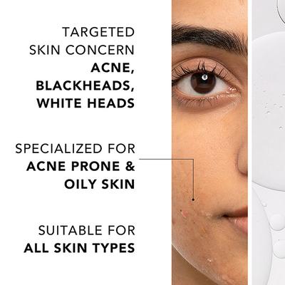 Novology Acne Clearing Serum with Thymol and Terpineol - Non-Drying, Non-Irritating 28 ml - Face Serum