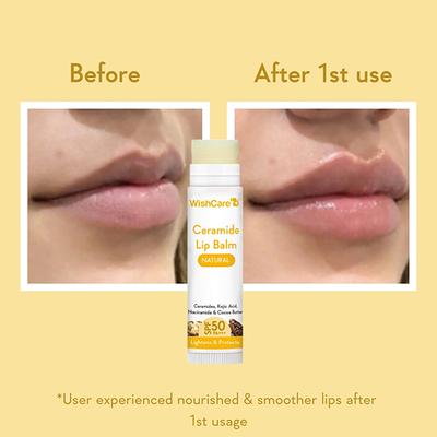 Wishcare Natural Ceramide Lip Balm for Dark Pigmented Lips with SPF50 PA+++ Heals Chapped Lips (5gm) - Lip Balms