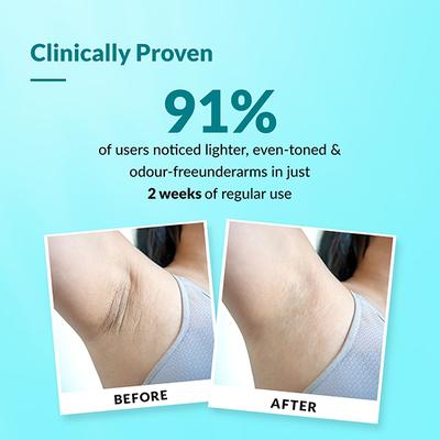 Fixderma Nigrifix Underarm Roll On With 6% AHA, Lactic Acid & 1% Mandelic for Men & Women (60 ml) - Deodorants/Roll-Ons