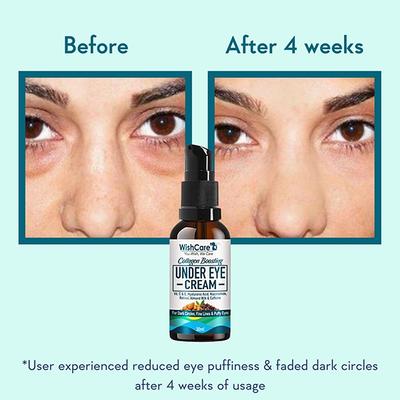 WishCare Collagen Boosting Under Eye Cream For Dark Circle Puffy Eyes & Wrinkles - Coffee & Almond 30 ml - Under Eye Creams & Serums