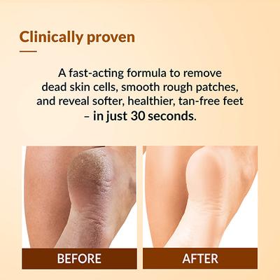 Fixderma Foobetik Foot Scrub Spray Dead Skin & Tan Removal Darkness Blackness Removal Scrub 50 ml - Foot Care