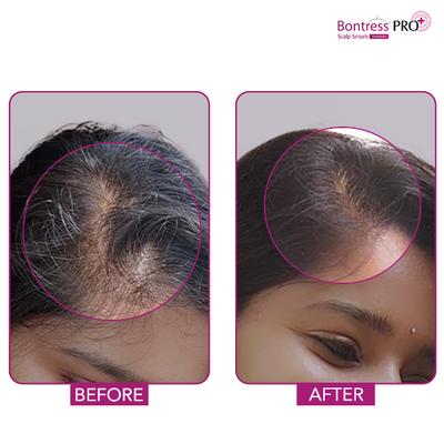 Bontress Pro Plus Scalp Serum 30 ml - Hair Serums
