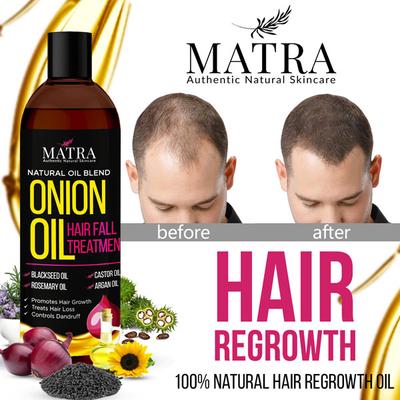Matra Hair Fall Treatment Oil - Onion 100 ml - Hair Oils