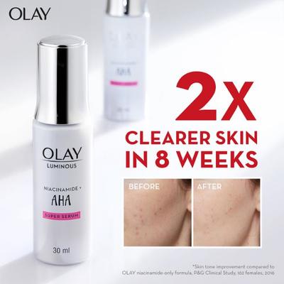 Olay Luminous Niacinamide + AHA Moisturizer Reduce Acne Marks for Clearer, Smoother Skin 50gm - Face Moisturizers