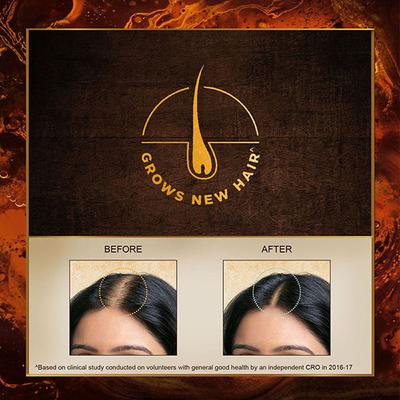 Indulekha Bringha Oil Grows New Hair 100 ml - Hair Oils