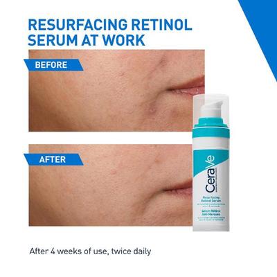 CeraVe Blemish Control Cleanser 236 ml - Face Scrubs