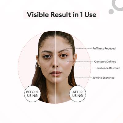 Protouch Glow Pro - Microcurrent Facial Toning Device - Blush 1's - Massagers