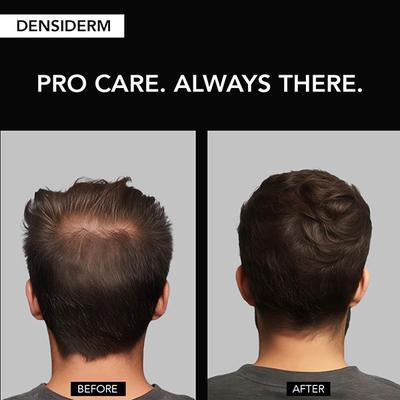 O3+ Men Densiderm Hair Growth Serum Scalp Spray with Ginseng For Hair Fall Control & Hair Growth 50ml - Hair Serums