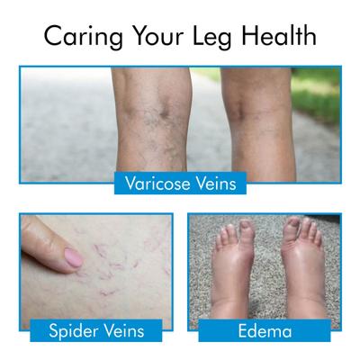 AccuSure Varicose Vein Stockings (XL) 1's - Knee/Ankle/Leg/Foot Supports