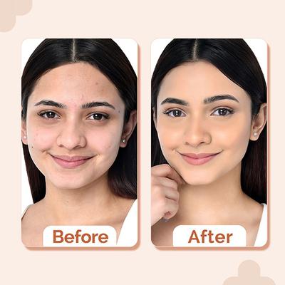 The Derma Co. 2% Niacinamide High Coverage Foundation, 1% Hyal. Acid and SPF 40 PA+++ for 12 Hr - 01 Ivory 30 gm - Foundation