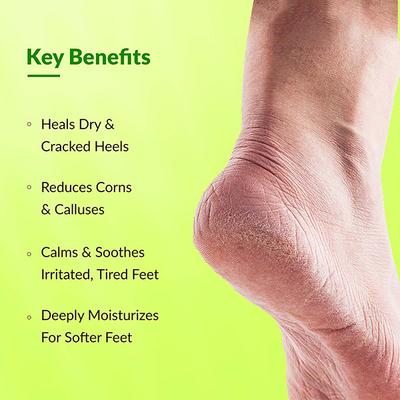 Fixderma Foobetik Foot Cream for Diabetic, Dry & Crack Heel, Moisturizes & Repair Feet (100 g) - Face Creams