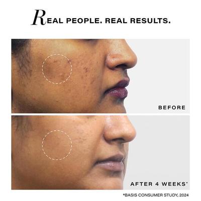 Novology Pigmentation Reduction Moisturiser for Dark Spots, Acne Marks and Uneven Skin Tone 50 gm - Face Sunscreen