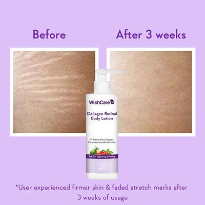 Wishcare Collagen 1% Retinol Anti-Ageing Body Lotion With Niacinamide For Skin Tightening (200ml) - Lotions & Creams