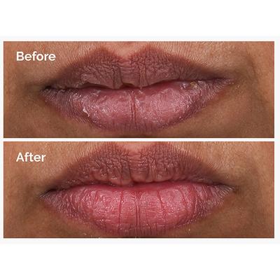 The Ordinary Pha 5% Lip Exfoliating Serum 15 ml - Face Serum