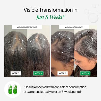 Beautywise Hair Rescue, Biotin & Keratin, for Hairfall Control & Growth 30's - Multi-Vitamins