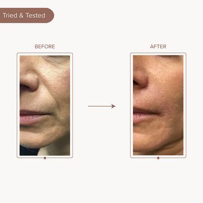 Dromen and Co Lifting and Firming Undereye and Cheek Strips 3's - Sheet Masks