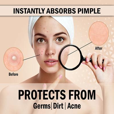 Urban Yog Acne Pimple Patch 72 Invisible Facial Stickers 1's - Masks & Peels