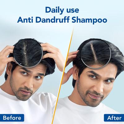 Scalpe Pro Daily Anti Dandruff Shampoo 100 ml - Shampoos