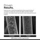 Minimalist Hair Repair Complex 5% Serum with Amino Acids, Argan Oil & Squalane 50 ml - Hair Serums
