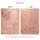 Resolve Bear Hug Barrier Restoring Lotion Fragrance Free 50 gm - Face Moisturizers