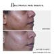 Novology Acne Clearing Cleanser for Acne, Whiteheads & Blackheads - Suitable for Sensitive Skin 150 gm - Face Wash & Cleansers