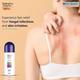 Terfin 1% Dusting Powder 100gm - Fungal Infections-Taa