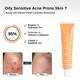 The Formularx Barrier Relief Ceramide Lightweight Moisturizer for Oily, Acne Prone & Sensitive Skin 50 gm - Face Moisturizers