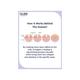 Gubb Derma Roller 0.5 Needle Grey 160 gm - Derma Rollers