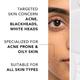 Novology Acne Clearing Serum with Thymol and Terpineol - Non-Drying, Non-Irritating 28 ml - Face Serum