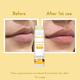 Wishcare Natural Ceramide Lip Balm for Dark Pigmented Lips with SPF50 PA+++ Heals Chapped Lips (5gm) - Lip Balms
