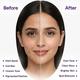 Kozilite H Cream 20gm - Dry Skin-Emo