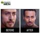 Garnier Men Acno Fight Anti-Pimple Facewash for Acne Prone Skin 150 gm - Face Washes