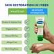 Cetaphil Dam Lotion 100gm - Lotions & Creams
