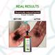 Nature Spell Rosemary With Jamaican Black Castor Oil For Hair & Skin 150 ml - Hair Oils