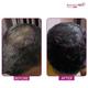Bontress Pro Plus Scalp Serum 30 ml - Hair Serums