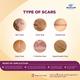 SCAREND SILICONE Gel 15g - General-P
