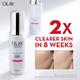 Olay Luminous Niacinamide + AHA Moisturizer Reduce Acne Marks for Clearer, Smoother Skin 50gm - Face Moisturizers