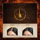 Indulekha Bringha Oil Grows New Hair 100 ml - Hair Oils