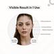 Protouch Glow Pro - Microcurrent Facial Toning Device - Etoupe 1's - Massagers