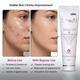 Sebogel Gel 30gm - Acne-Acn