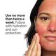 The Ordinary AHA 30% + BHA 2% Peeling Solution 30 ml - Masks & Peels