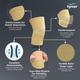 Tynor Knee Cap Large D04 1 Pair - Knee/Ankle/Leg/Foot Supports