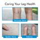 AccuSure Varicose Vein Stockings (XL) 1's - Knee/Ankle/Leg/Foot Supports
