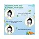 Everyuth Naturals Anti Acne Anti Marks Tulsi Turmeric Face Wash 150 gm - Face Wash & Cleansers
